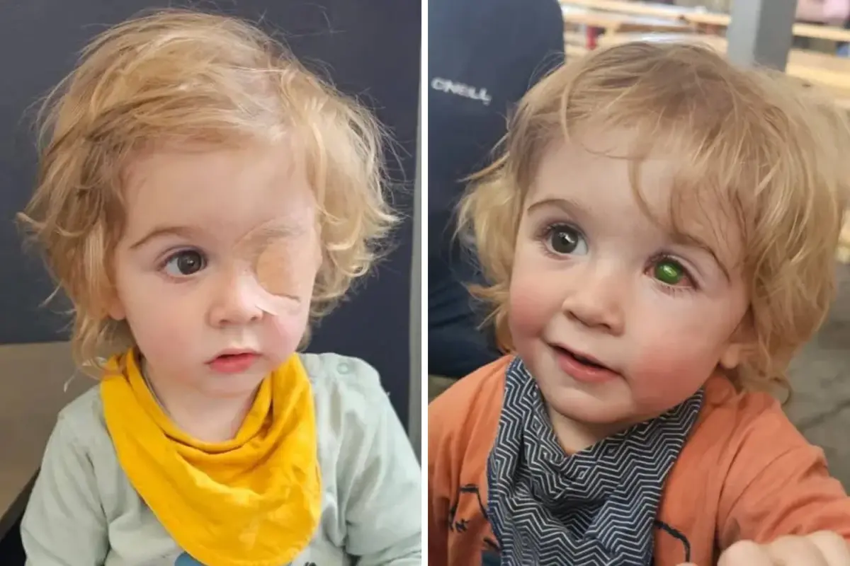 2 yaşındaki çocuk bir öpücük yüzünden gözünü kaybetti