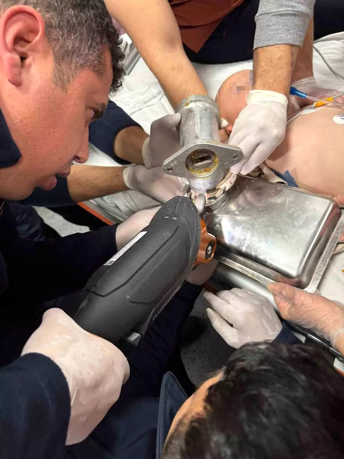 Hatay'da 2 Yaşındaki Çocuğun Eli Kıyma Makinesine Sıkıştı