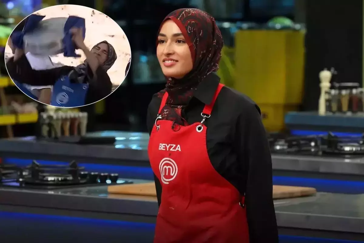 MasterChef Beyza, yanan yüzünün fotoğrafını 